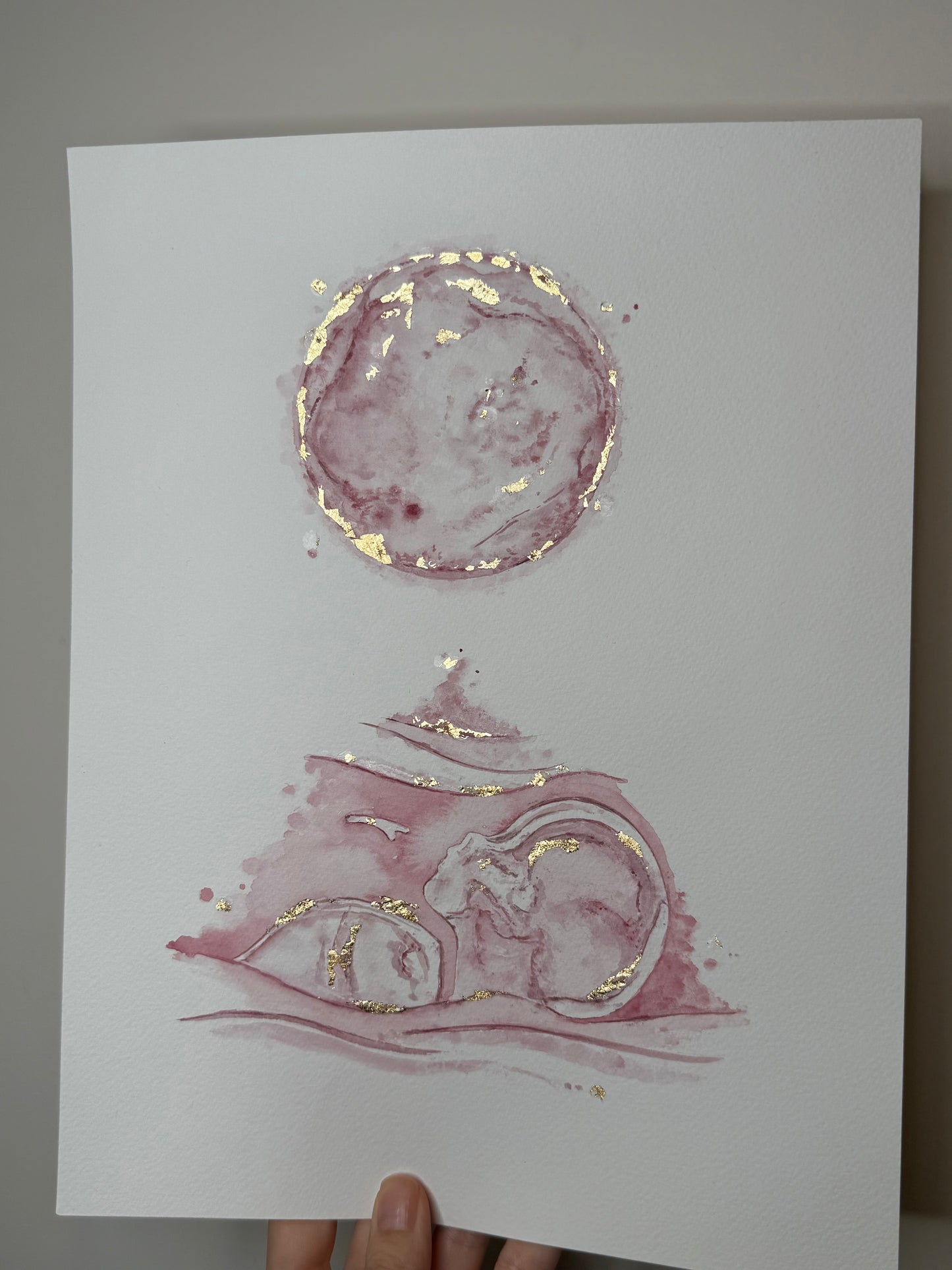 Embryo + Ultrasound Scan