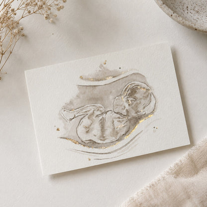 Artistic depiction of an ultrasound/sonogram watercolour painting with dried flowers and a bowl in the background.