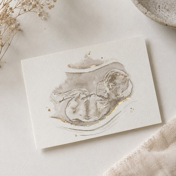 Artistic depiction of an ultrasound/sonogram watercolour painting with dried flowers and a bowl in the background.