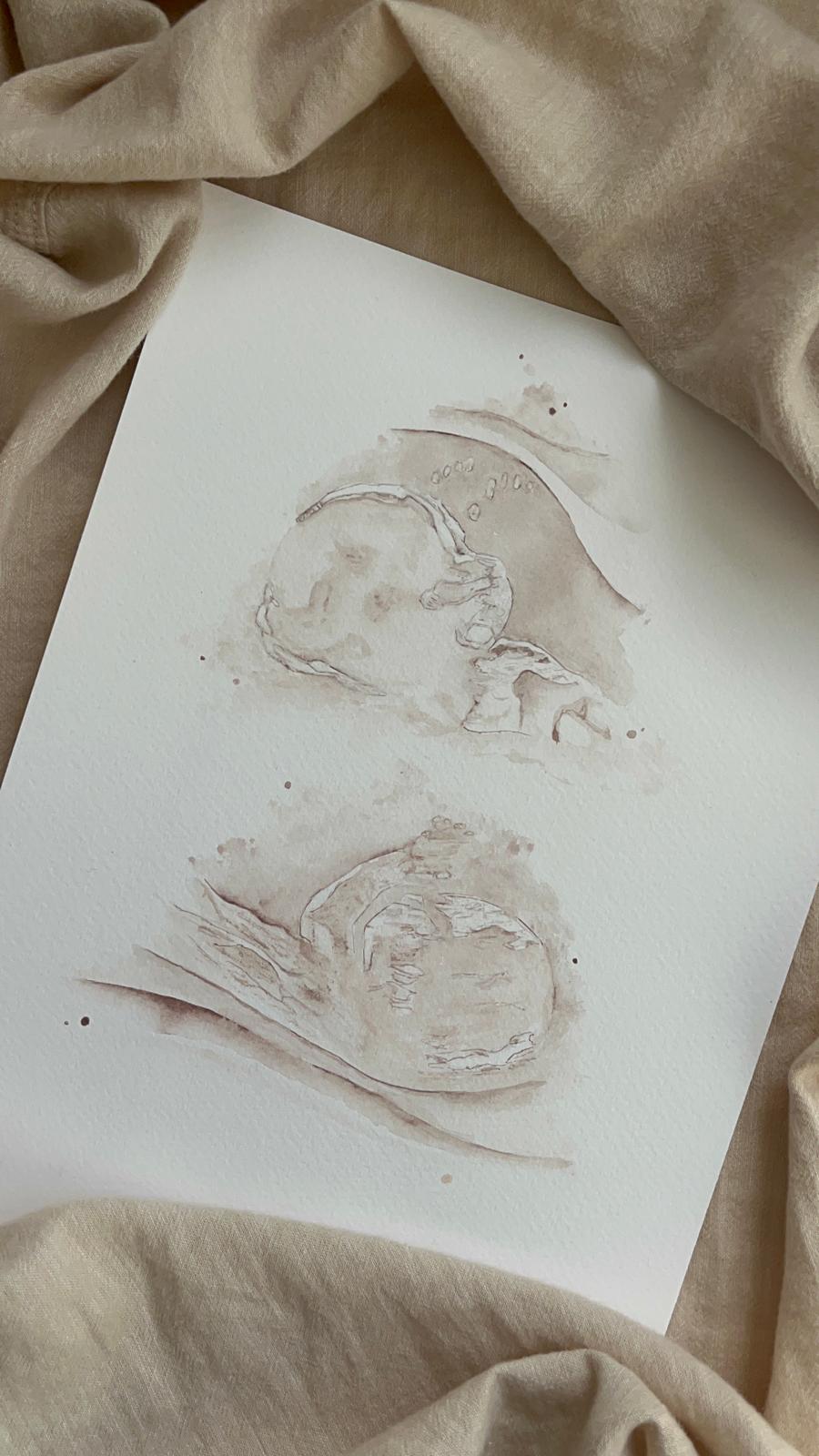 Watercolour Ultrasound Scan