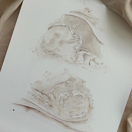 Double  Watercolour Ultrasound Scan